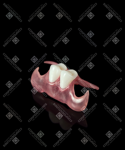 Flexible Partial Denture Prices Confidentures The Denture Experts