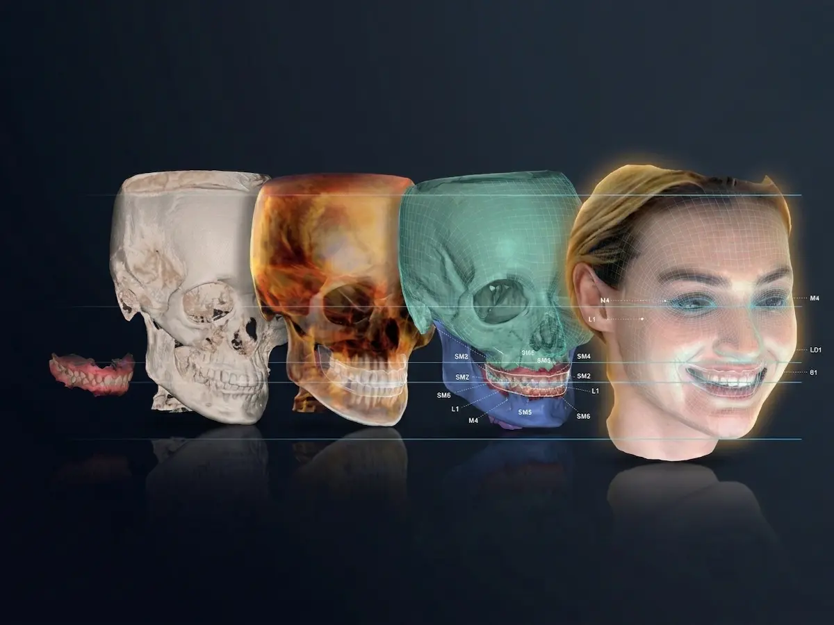 A glowing 3D digital facial scan displaying muscle segmentation, nerve architecture, and a holographic blueprint for immediate dentures. Confidentures in Auckland utilizes this advanced pre-surgical mapping to engineer exact transitional prosthetics before tooth extraction.