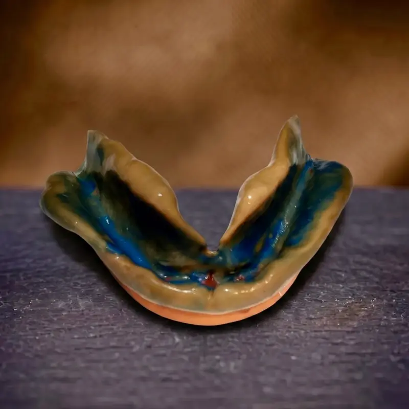 A detailed clinical functional impression used by the Confidentures Rosedale team to engineer secure, SEMCD lower-suction dentures on the North Shore.