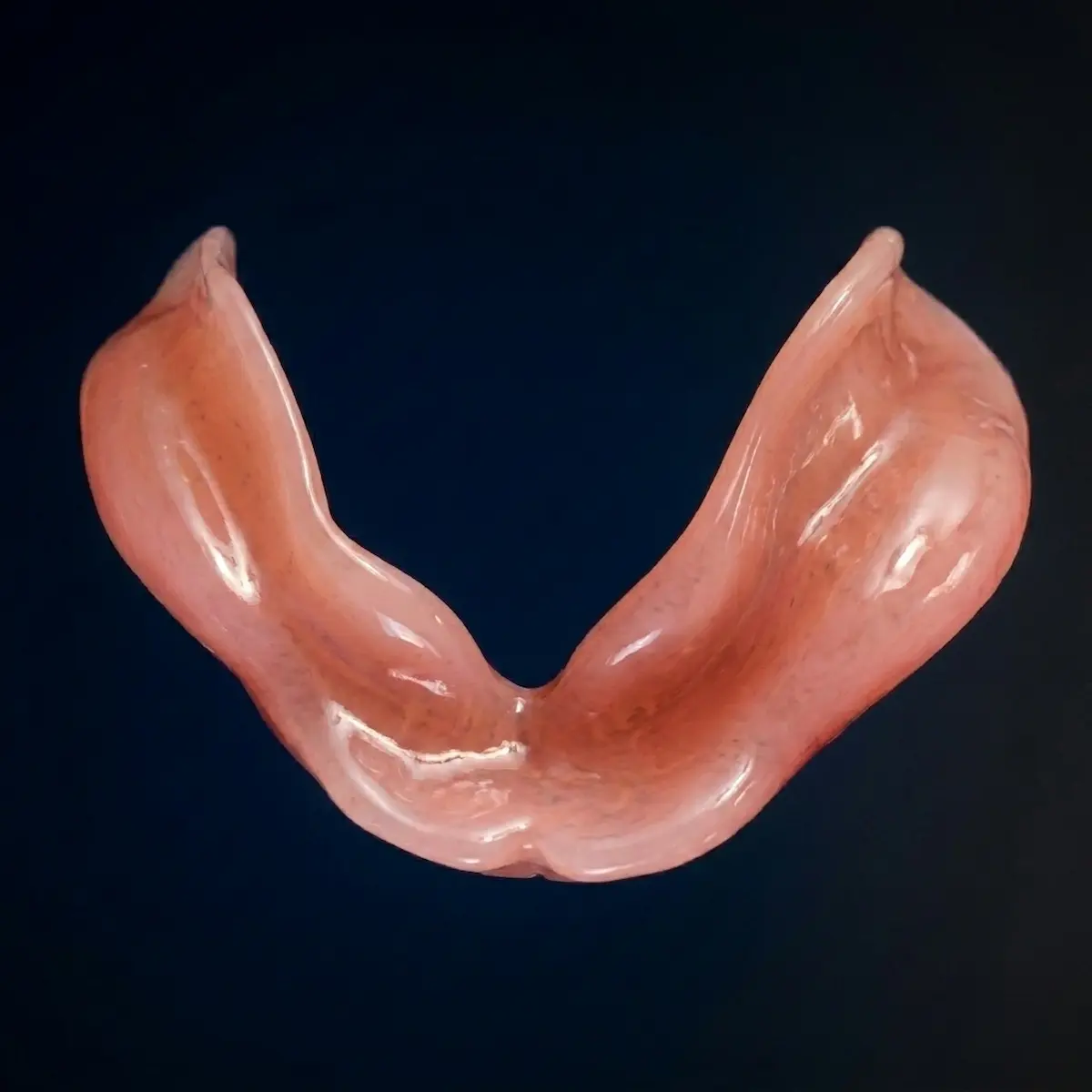 Macro view of the smooth internal fitting surface of a precision-milled lower denture. Manufactured using advanced VHF K5+ CAD/CAM technology at Confidentures in Auckland, this digital prosthetic utilizes microscopic tissue-relief engineering to float seamlessly over painful bone spicules and sensitive nerve exits.